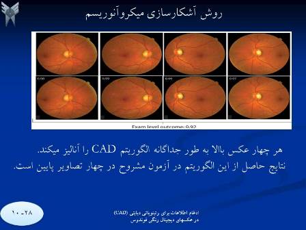 ImageProcessing-cad5 پردازش تصویر ادغام اطلاعات برای رتینوپاتی دیابتی با استفاده از الگوریتم CAD درعکسهای فوندوس دیجیتال رنگی